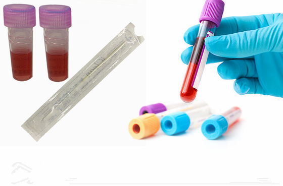 Flocked DNA Buccal Swabs สำหรับการสุ่มตัวอย่างไนลอนไฟเบอร์ปลอดเชื้อสำหรับการขนส่งด้วยหลอด
